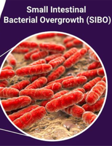 Small Intestinal Bacterial Overgrowth