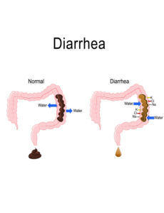 Diarrhea